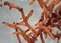 Mycorhiza