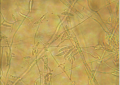 Fusarium