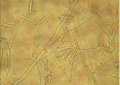 Fusarium