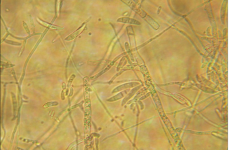 Fusarium