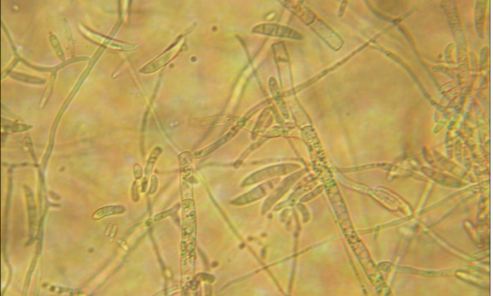 Fusarium