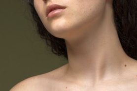 kapilární angiomy, červené tečky na kůži, stárnutí pokožky, dermatologie, kožní změny