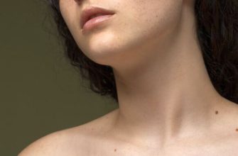 kapilární angiomy, červené tečky na kůži, stárnutí pokožky, dermatologie, kožní změny